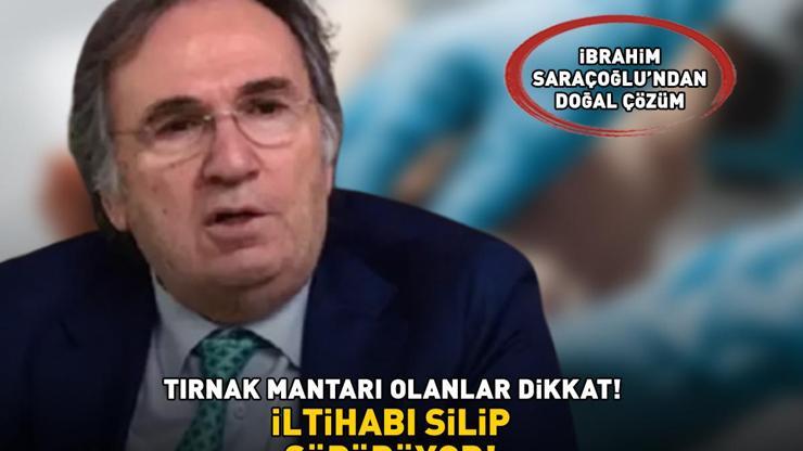 Tırnak mantarı olanlar dikkat İbrahim Saraçoğlundan doğal çözüm İltihabı silip süpürüyor, enfeksiyonlarına karşı kalkan görevi görüyor