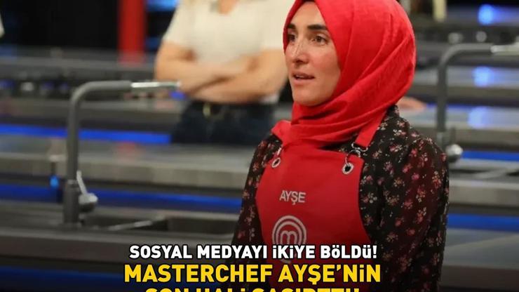 MasterChef Ayşe Ekizin son hali şoke etti Estetikli görüntüsü sosyal medyayı 2ye böldü