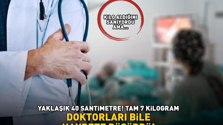 YAKLAŞIK 40 SANTİMETRE, TAM 7 KİLOGRAM Doktorları bile hayrete düşürdü Kilo aldığını sanıyordu, gerçek çok farklı çıktı