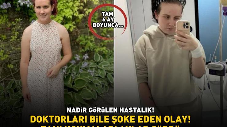 DOKTORLARI BİLE ŞOKE EDEN OLAY Nadir görülen hastalık Artık yaşamını kalıcı kateterle sürdürüyor
