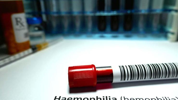 Hemofili hastalarına uyarı: Doktor kontrolleri aksatılmamalı