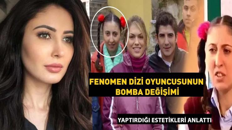HAYAT BİLGİSİNİN KİKİRİKİNDEN BOMBA DEĞİŞİM Çisil Oralın estetikli son hali