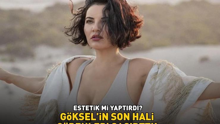 ESTETİK Mİ YAPTIRDI Gökselin son hali sosyal medyayı salladı