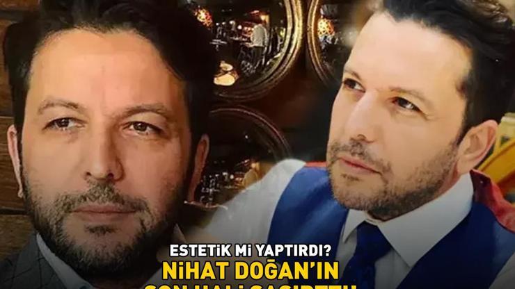 ESTETİK Mİ YAPTIRDI Nihat Doğanın son hali şoke etti