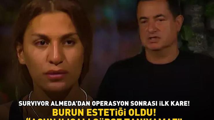 BURUN ESTETİĞİ OLDU Survivor Almeda sosyal medyayı 2ye böldü Acun Ilıcalı görse tanıyamaz