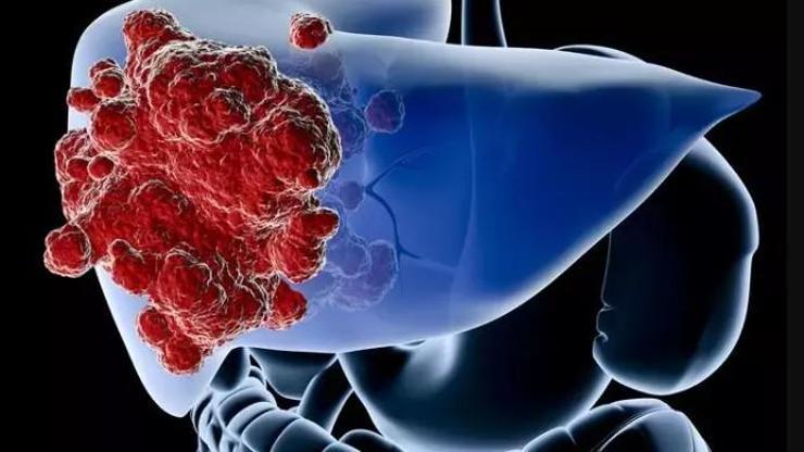 Karaciğer Sağlığını Destekleyen Besinler: Güçlü Bir Karaciğer İçin Bu Gıdaları Tüketin