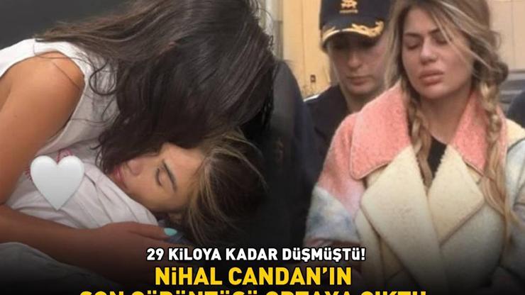 Anoreksiya nedeniyle 29 kiloya kadar düşmüştü Nihal Candanın son görüntüsü ortaya çıktı