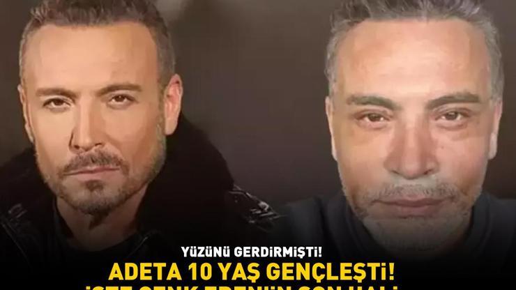 Yüzünü gerdirmişti Adeta 10 yaş gençleşti Cenk Erenin son hali gündem oldu
