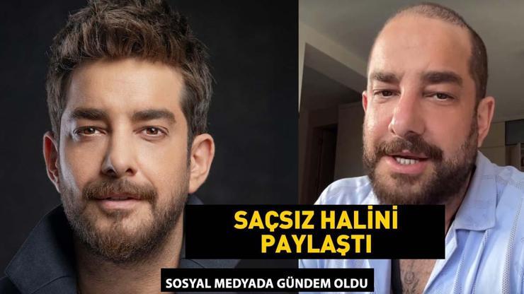Enis Arıkanın saçsız hali gündem oldu Meğer protez saç kullanıyormuş