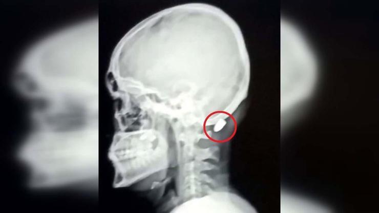 Çoğu Zaman Fark Edilmiyor, Tesadüfen Bulunuyor Uzman İsimden Hayati Uyarı: Silah Sesi Duyduğunuzda Balkona Pencereye Koşmayın