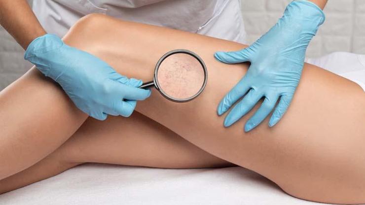 Sıcak hava varislerin artmasına sebep olabilir