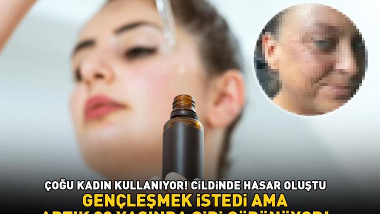 Aman dikkat Güzelleşmek isterken kabusu yaşadı 80 YAŞINDA GİBİ GÖRÜNÜYORUM