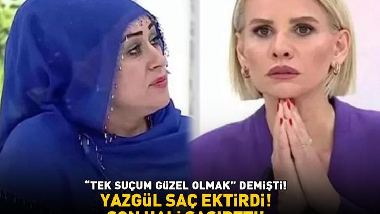 Esra Erolda Tek suçum güzel olmak demişti Saç ektiren Yazgülün son hali şaşırttı