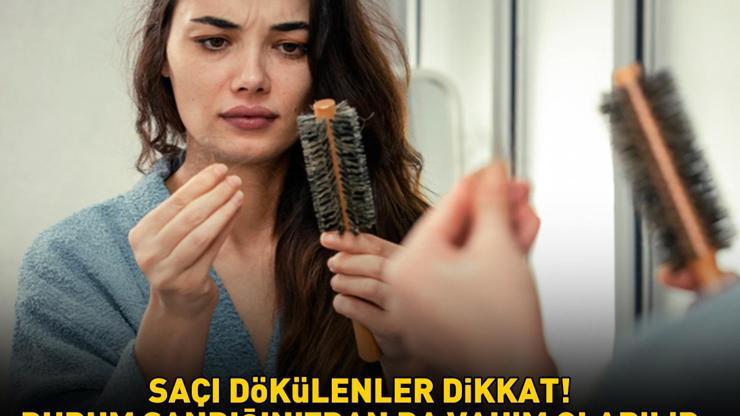 SAÇI DÖKÜLENLER DİKKAT Durum sandığınızdan da vahim olabilir: Tiroid problemleri, PKOS, Demir ve D vitamini eksikliği...