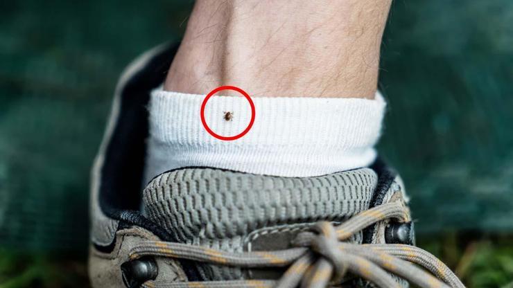 KENE VüCUTTA EN ÇOK BURALARA YAPIŞIYOR İşte Kontrol Etmeniz Gereken 6 Bölge