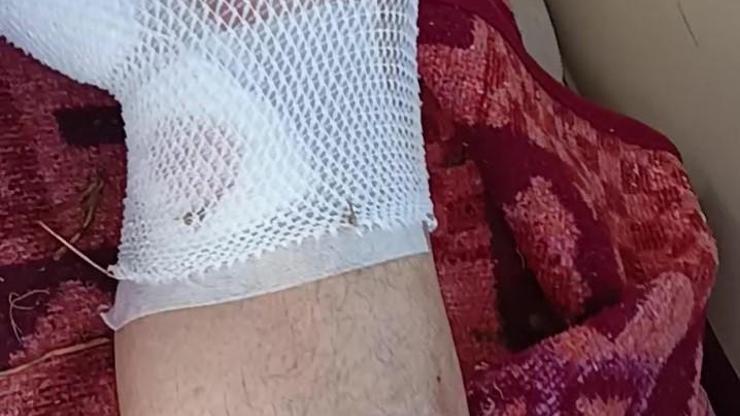 Aslanın pençesinden kurtulan Süleyman Kır dehşeti anlattı: Baldırımı ısırdı boynunu sıktım