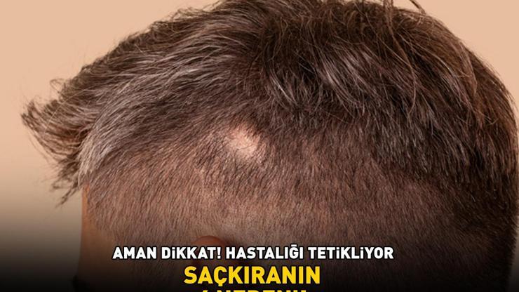 Aman dikkat Hastalığı tetikliyor SAÇKIRANIN 4 NEDENİ