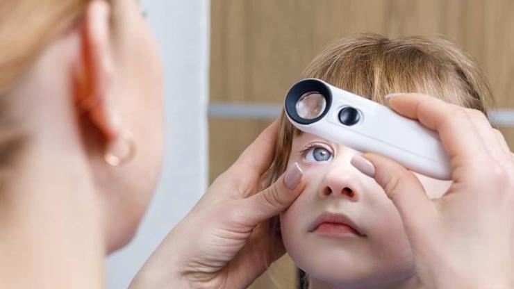 Gözde Sessiz Tehlike: Alerji Kornea Hasarına Yol Açabiliyor Uzman Uyardı