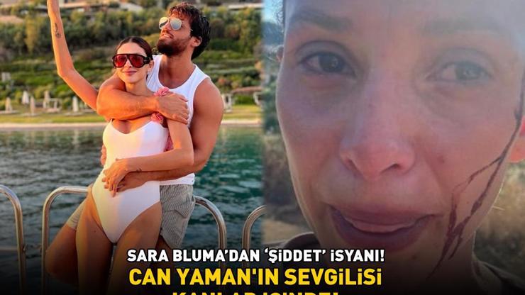Can Yaman’ın büyük aşkı Sara Bluma kanlar içinde Ünlü oyuncu, şiddet gören sevgilisine böyle destek verdi: YANINDAYIM