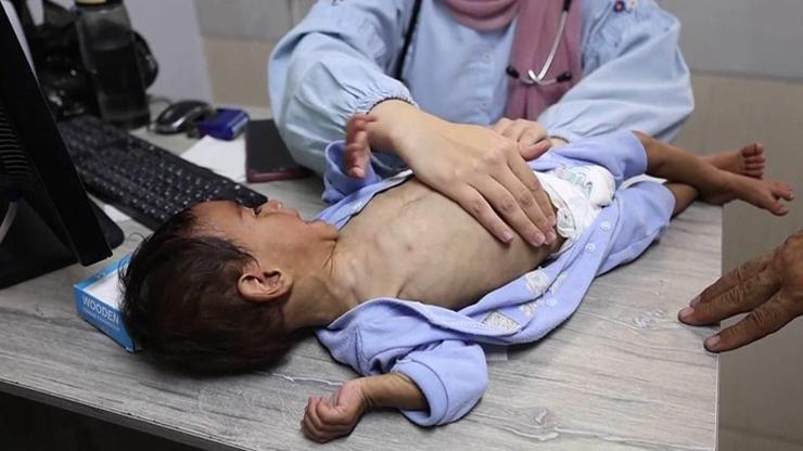 NE GIDA, NE İLAÇ, NE SÜT | Gazze ölüyor dünya sessiz