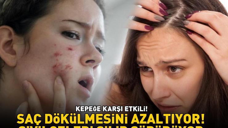 KEPEĞE KARŞI ETKİLİ Saç dökülmesini azaltıyor; ciltteki bakteriyel sorunları, akne ve sivilceleri silip süpürüyor