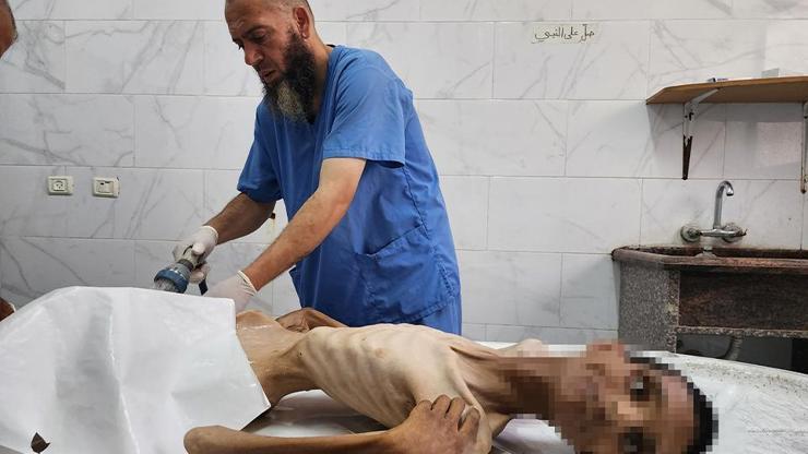 İsrail ablukasında Gazzede korkunç insani kriz: 27 yaşındaki genç yetersiz beslenme nedeniyle yaşamını yitirdi