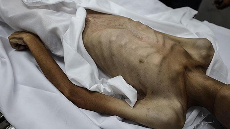 İsrail ablukasındaki Gazze Şeridi'nde son 24 saatte 1'i çocuk 7 kişi daha açlıktan hayatını kaybetti İsrail ablukasındaki Gazze Şeridi'nde son 24 saatte 1'i çocuk 7 kişi daha açlıktan hayatını kaybetti