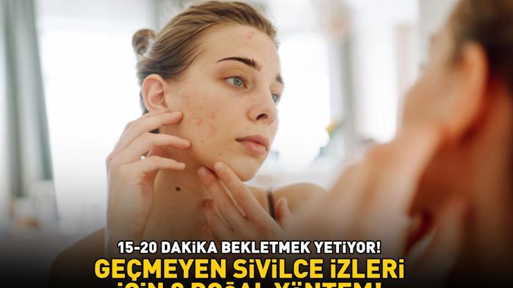 GEÇMEYEN SİVİLCE İZLERİ İÇİN 3 DOĞAL YÖNTEM Cildi bebek gibi yapıyor 15-20 dakika bekletmek yetiyor