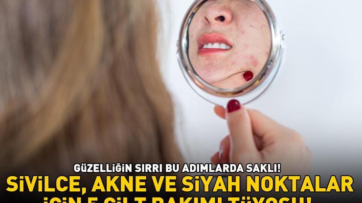 GÜZELLİĞİN SIRRI BU ADIMLARDA SAKLI Sivilce, akne ve siyah noktalar için 5 cilt bakımı tüyosu
