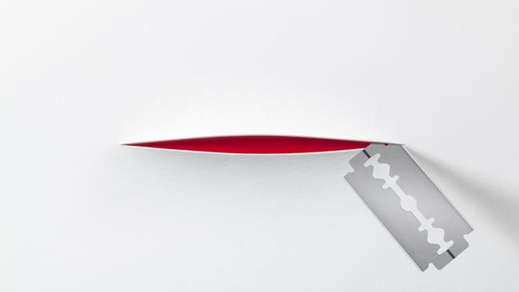 Jilet İzi Nasıl Geçer? Vücutta Faça, Jilet İzleri Nasıl Yok Edilir? Jilet İzi Nasıl Geçer? Vücutta Faça, Jilet İzleri Nasıl Yok Edilir?