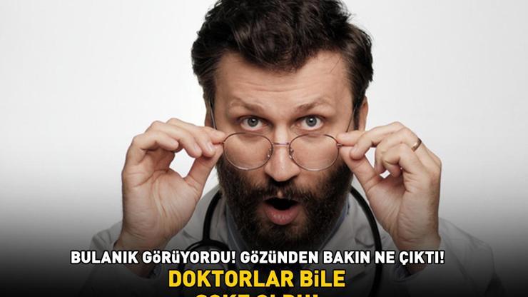 DOKTORLAR BİLE ŞOKE OLDU 8 ay boyunca bulanık gören adamın gözünden bakın ne çıktı