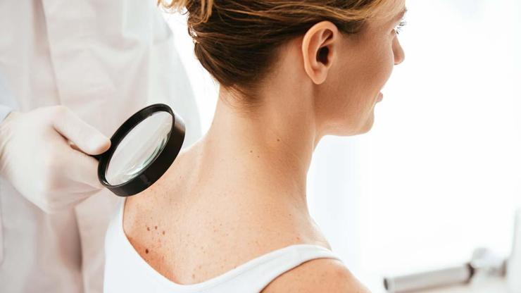 Soğuk Havada Cilt Kuruluğu Masum Değil Altından Ciddi Sorunlar Çıkabilir