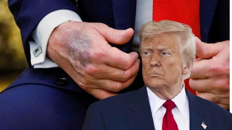 Trump’ın elindeki morluk yine olay oldu