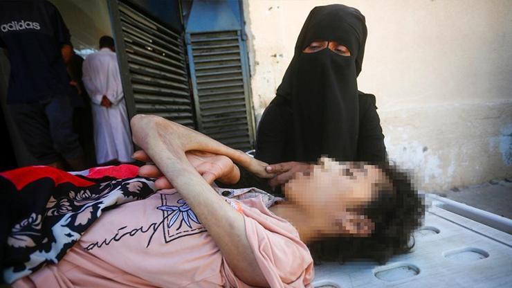 İsrailden açlıkla işkence Gazzede vahşet bitmiyor: 20 yaşındaki Şeyma hayatını kaybetti
