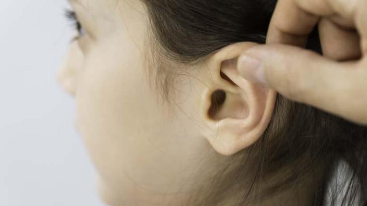 Kepçe kulak estetiği ile özgüven artıyor