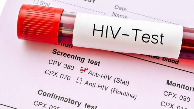 Türkiyede HIV ile yaşayan her 3 kadından 1inde var