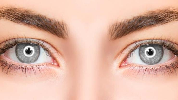 GÖZ RENGİ NASIL OLUŞUR Ela, Kahverengi, Siyah, Mavi ve Yeşil... Gözdeki Renk Farklılıklarının Arkasında Ne Var