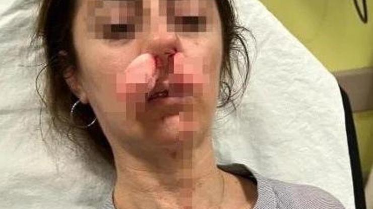 Eşinin sevgilisi sanıp darp etti İddianamede şok detay: Otomobil kapısı silah sayıldı