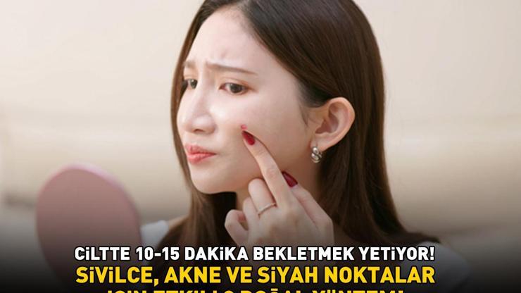 Pahalı ürünlere gerek yok Sivilce, akne ve siyah noktalar için etkili 3 doğal yöntem Ciltte 10-15 dakika bekletmek yetiyor