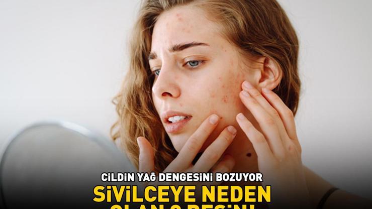 SİVİLCE YAPAN 8 BESİN Cildin yağ dengesini bozuyor, akne ve siyah noktaya neden oluyor