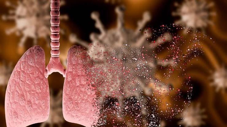 YAĞLI ZATÜRREYE DİKKAT Sinsi Tehlike Yavaş Yavaş Akciğerleri Yok Ediyor İçeriğini Duyunca Şoke Olacaksınız