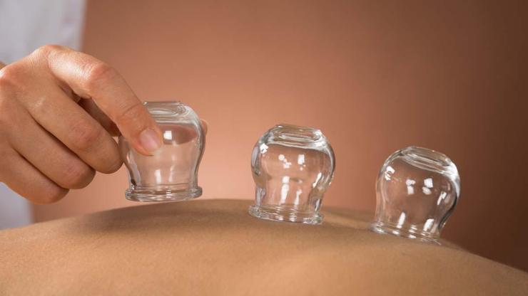 KUPA TEDAVİSİ VE FAYDALARI: Tarihi 4000 Yıl Öncesine Dayanıyor Bağışıklığı Güçlendiriyor, Ağrıyı Dindiriyor, Toksinleri Atıyor... Faydası Say Say Bitmiyor