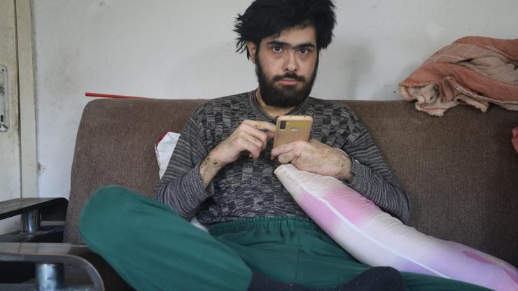Türkiye ona üzülmüştü Hatayda 3 yıl sonra duş alıp, tıraş olan Barışa teşhis konuldu