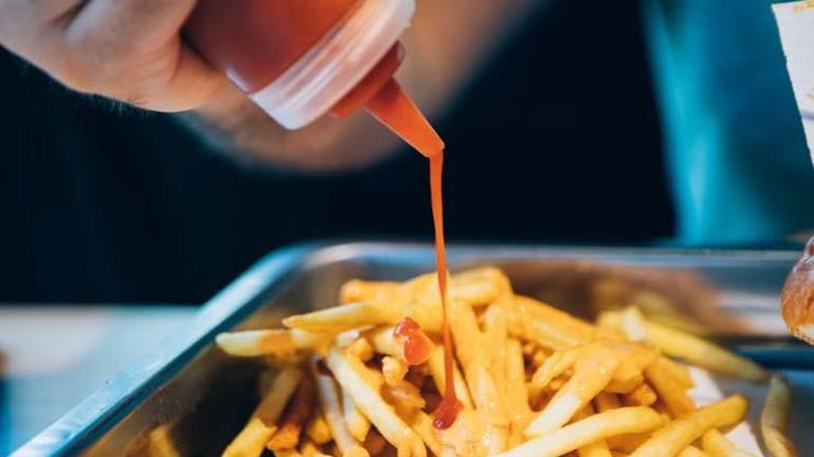 Bayıla Bayıla Yiyorsunuz Ama Karaciğeri Yağ Deposuna Dönüştürüyor Bu Belirtilere Dikkat Karaciğeriniz Alarm Veriyor Olabilir