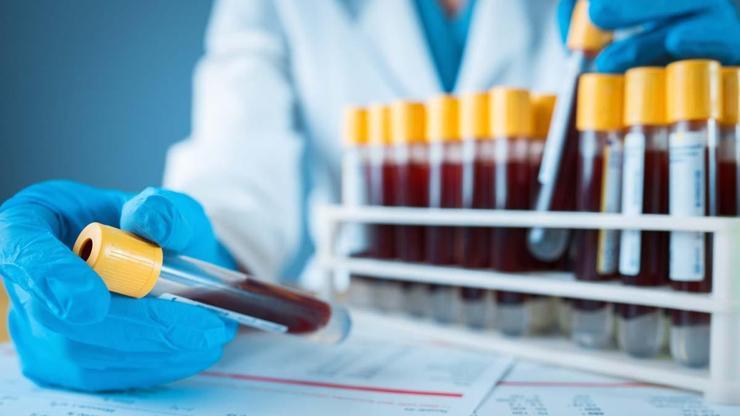 Çocuklardaki Bu Belirtiler Kan Hastalıklarını İşaret Ediyor Olabilir