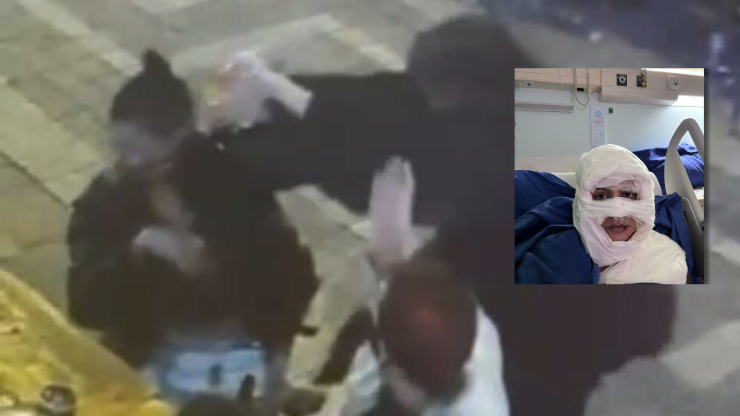 Kadıköyde kadının üzerine yanıcı madde dökmüştü Sanık için istenen ceza belli oldu