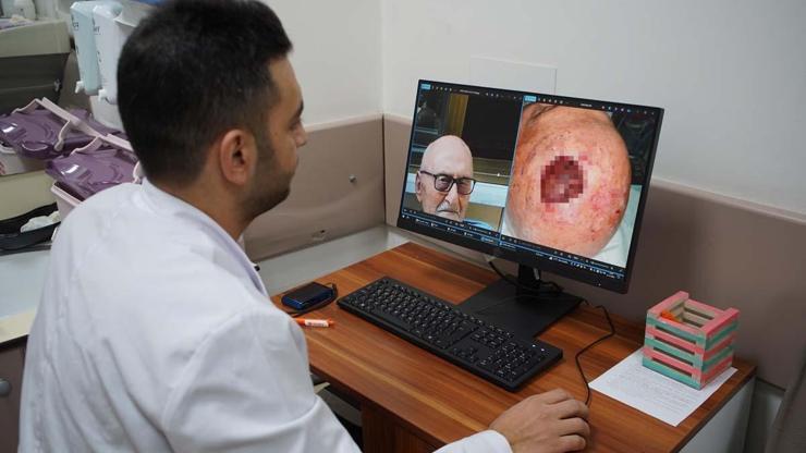 Dünyada 3üncü kez rastlandı Prof. Dr. Fahri Yılmaz: Alıştığımızın dışında bir tümör gördük