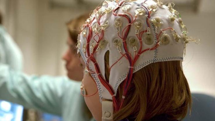 Epilepsi Nöbetini Haber Veren Başlık Geliştirildi Yüzde 95e Varan Doğru Sonuç