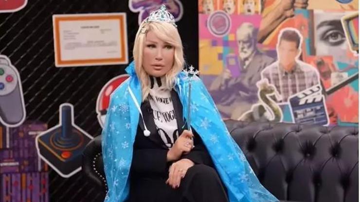 Yüzündeki Şişlik Merak Uyandırdı Sebebini Açıkladı