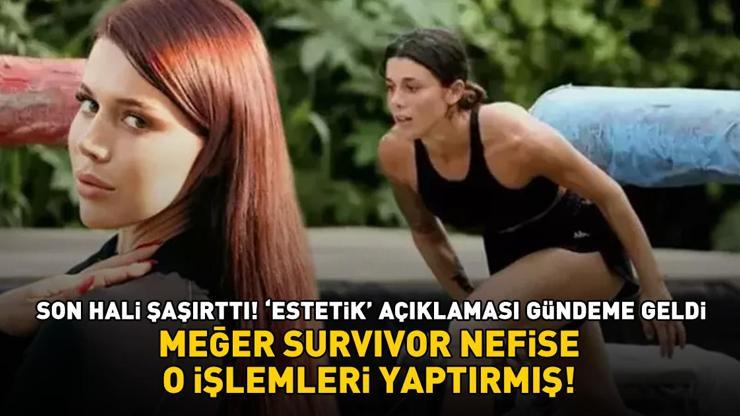 Survivor şampiyonu Nefise Karatay’ın son hali şaşırttı! 'Estetik' açıklaması tekrar gündeme geldi! Meğer o işlemleri yaptırmış...